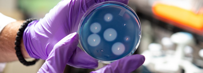 Gloved hands holds a petri dish with bacteria cultures.