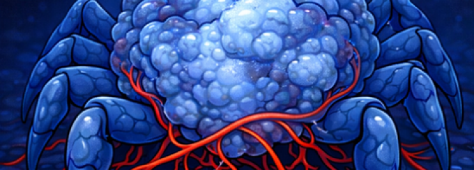 An illustration of red growth around a brain with spider legs.