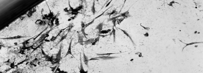 A gloved hand holding a pipette.