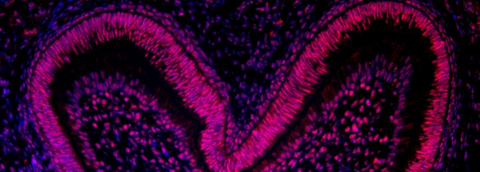 Immunofluorescence microscopy image. 