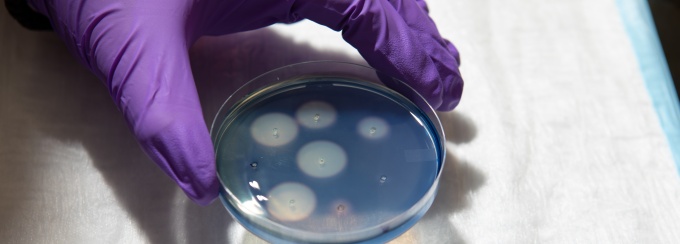 A gloved hand holding a pipette. 