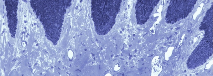 Gingiva under a microscope. 