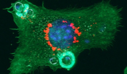 Cell picture.