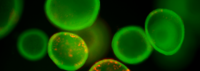 Aveolosphere under a microscope. 