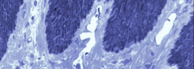 Gingiva under a microscope. 