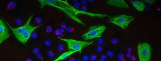 #CellsUnderaMicroscopeImage. 