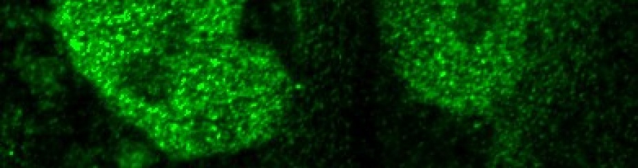 Cell nuclei in human embryonic stem cells. 