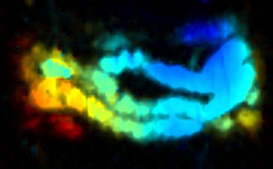 A mouse intestine illuminated by "nanojuice" and photoacoustic tomography. 