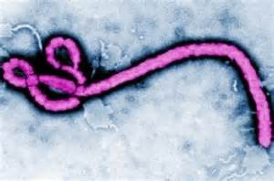 Microscope view of the Ebola virus. 