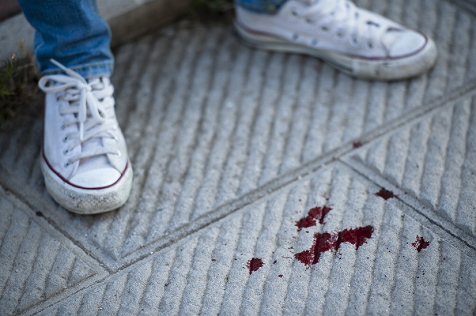 The sneakers and jeans of a person standing on a white rug that is spattered with blood.