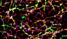 Microscope image of neurons, which look like streaks of fireworks on a dark background.