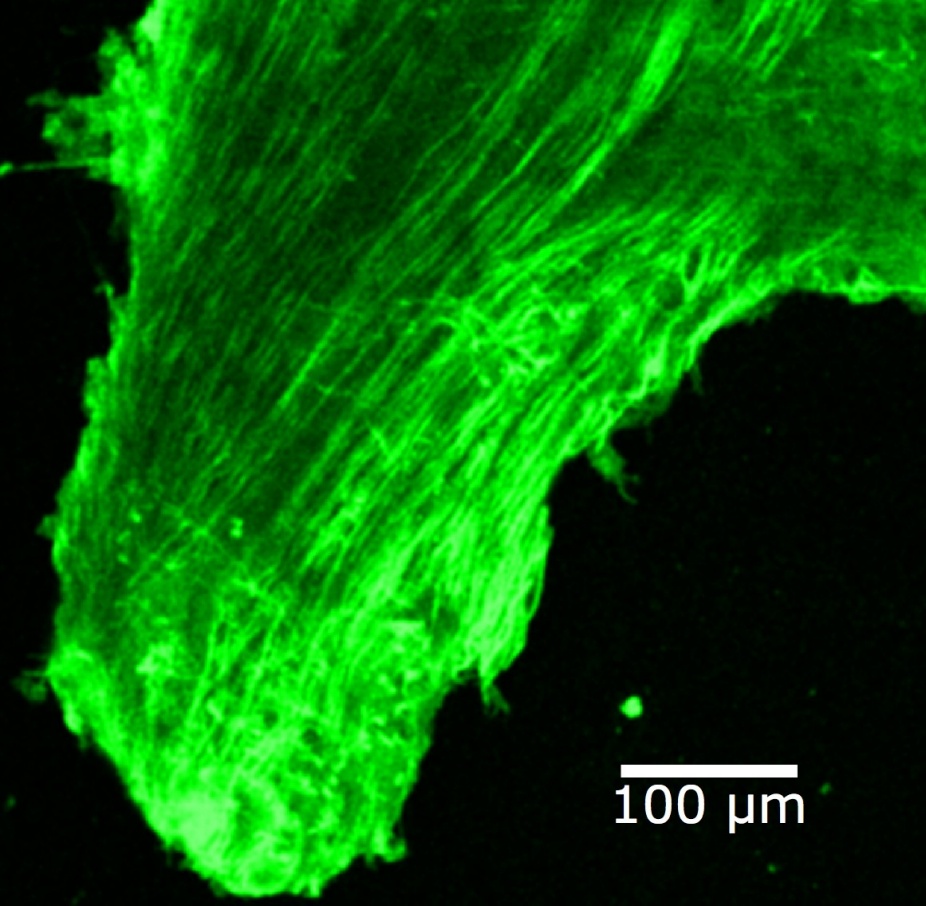 A green bundle of fibrous material. 