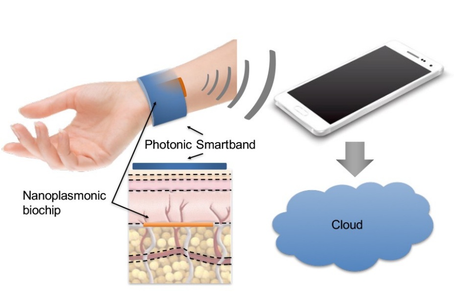 Illustration showing the implantable network. 