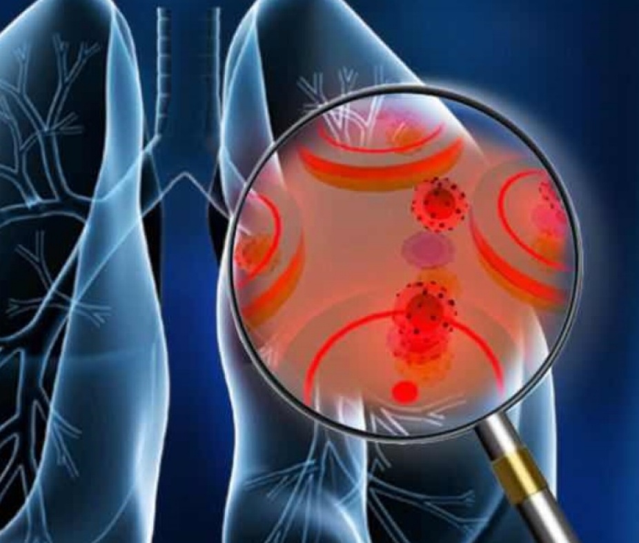 Conceptual illustration of cancer biosensor. 
