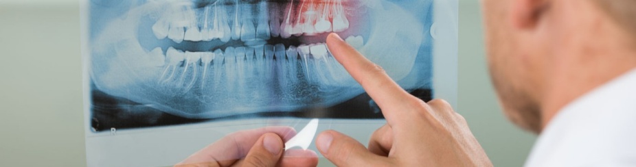 Man looking at teeth x-ray. 