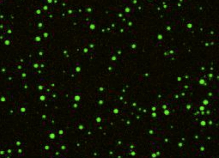 Zoom image: Like stars in the night, liquid droplets of RNA (the bright green spheres) float in a solution containing high concentrations of divalent magnesium cations. The droplets are imaged through confocal fluorescence microscopy. Credit: P. Onuchic, A. Milin, I. Alshareedah, A. Deniz and P. Banerjee, Scientific Reports, Aug. 21, 2019. This work is licensed under CC BY-4.0 (https://creativecommons.org/licenses/by/4.0/). 
