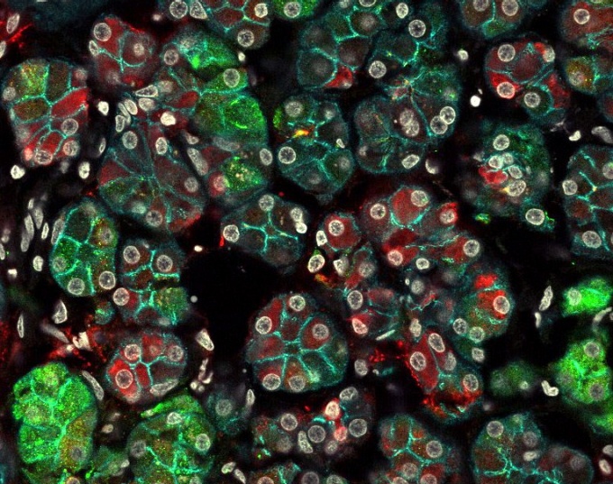 Zoom image: An immunofluorescence microscopy image of cells in a human submandibular gland. The image reveals that secretory acinar cells which were all thought to be the same, are actually much more diverse, as shown by the different cells in the same gland expressing different proteins. A green stain indicates the presence of mucin 7, and a red stain indicates the presence of amylase. Nuclei of cells are in grey, and the epithelial membrane in cyan. Credit: Alison May 