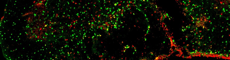 The inflamed tissue environment following demyelination prevents recruitment of oligodendrocyte progenitor cells (OPC) (green) and halts their division (red). 
